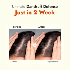 Al Ziba Cares Dandruff Care Scalp Moisturising Shampoo 200ml