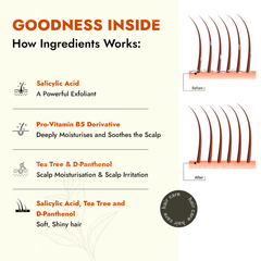 Al Ziba Cares Dandruff Care Scalp Moisturising Shampoo 200ml