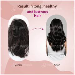 Ayouthveda Anti Hairfall Shampoo 200ml