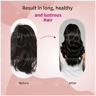 Ayouthveda Anti Hairfall Shampoo 200ml