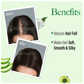 Kesh King Gold New & Improved Anti Hairfall Shampoo 340Ml