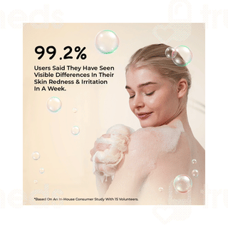 Sunny Herbals Derm Aid Soap 75gm