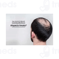 Minoqilib 5 Solution 60ml