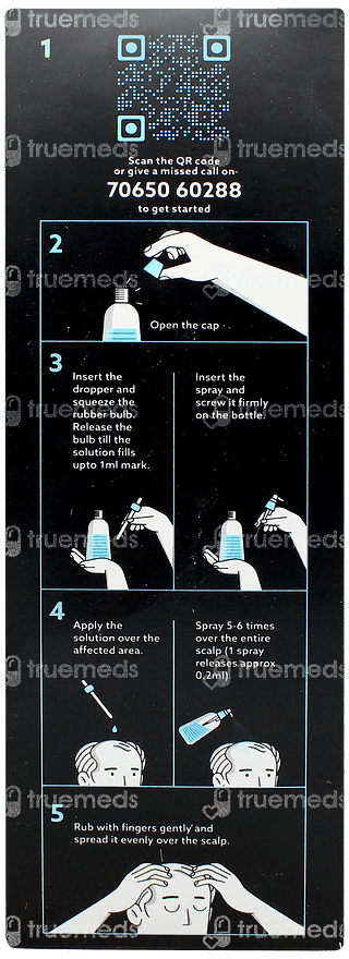 Mintop Forte 2 Solution 60ml