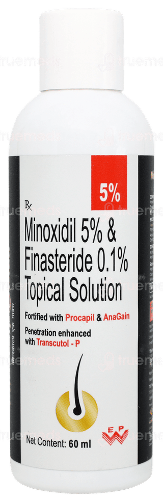 Minscalp F Max 5% Solution 60ml