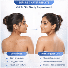 Saligly Body & Back Acne Spray 60ml