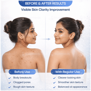 Saligly Body & Back Acne Spray 60ml