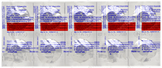 Ceftas 200 Tablet 10