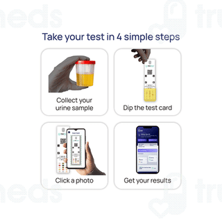 Neodocs Kidney Care Urine Test Kit 1