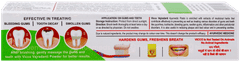 Vicco Vajradanti Saunf Flavour Paste 20Gm