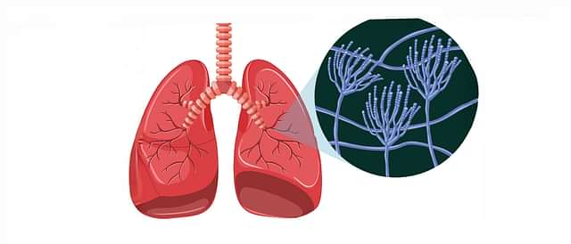 Respiratory