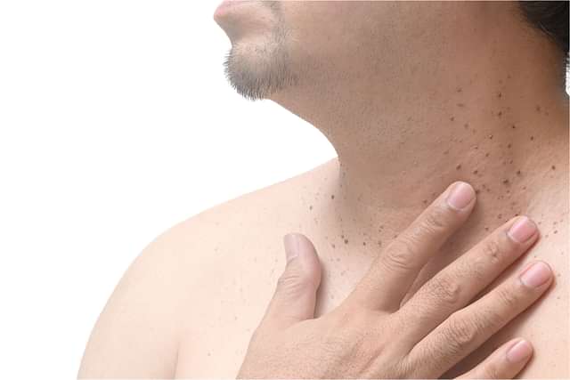 disease