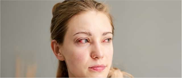 Eye