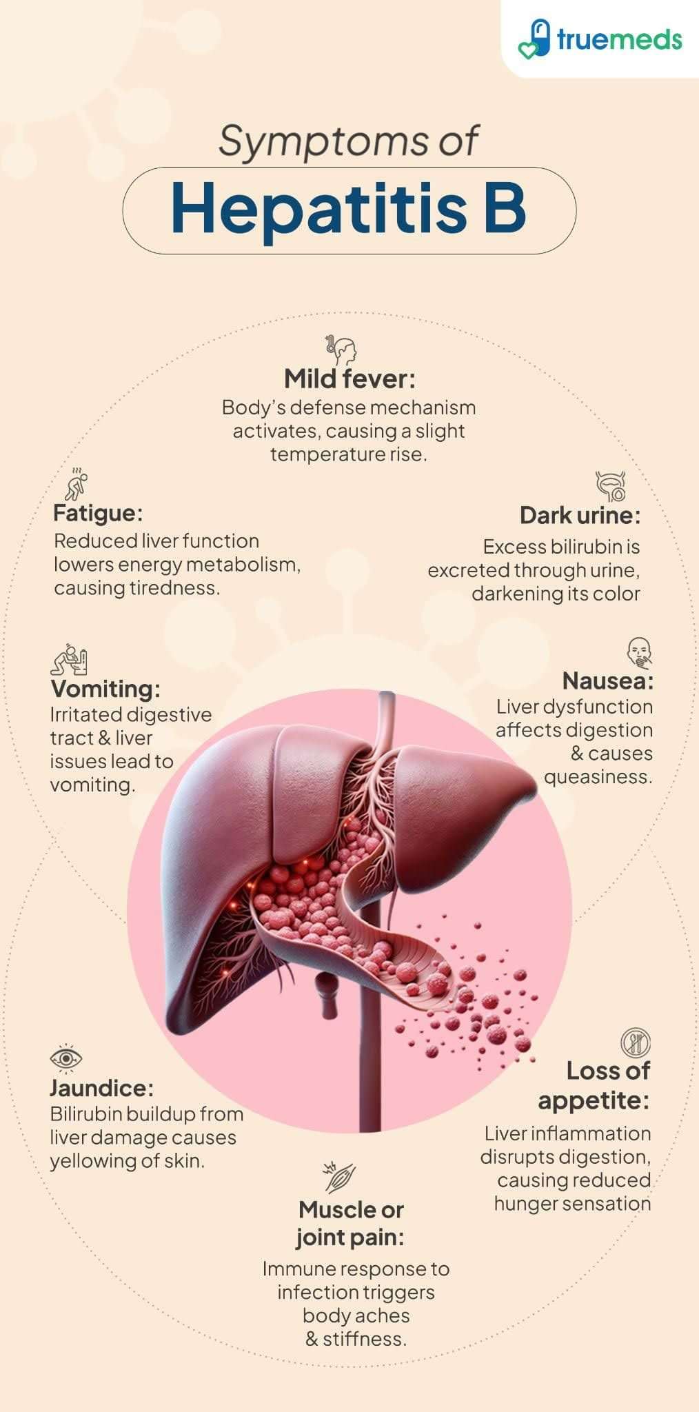 Symptoms of Hepatitis B infographic