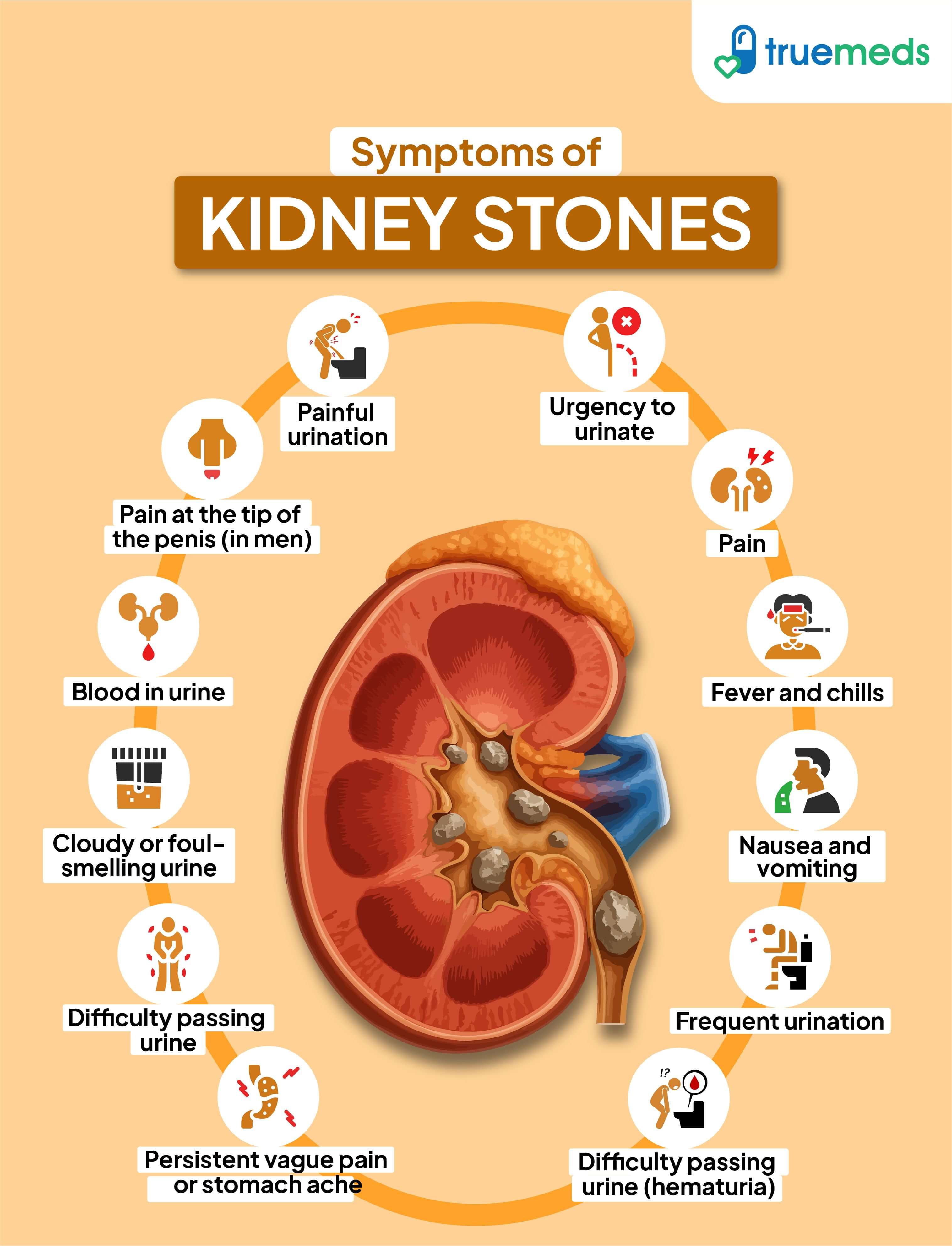 Infographic showing symptoms of kidney stones including painful urination, blood in urine, nausea, frequent urination, and lower abdominal pain.