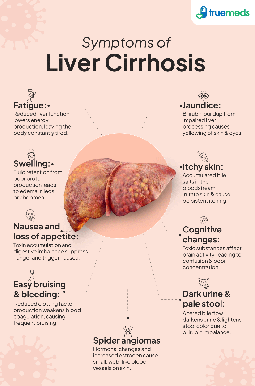 symptoms of liver cirrhosis infographic