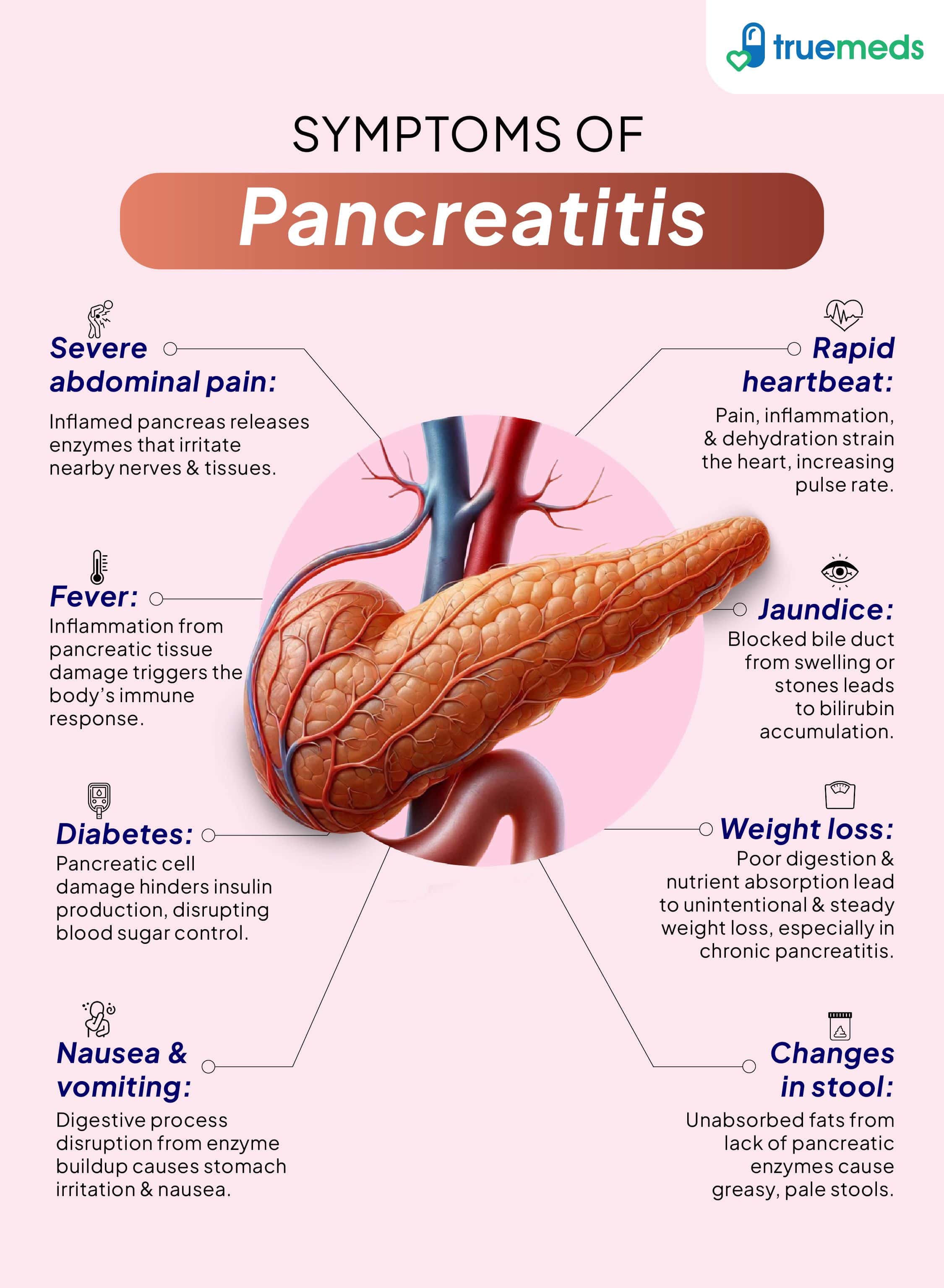 Symptoms of Pancreatitis infographic