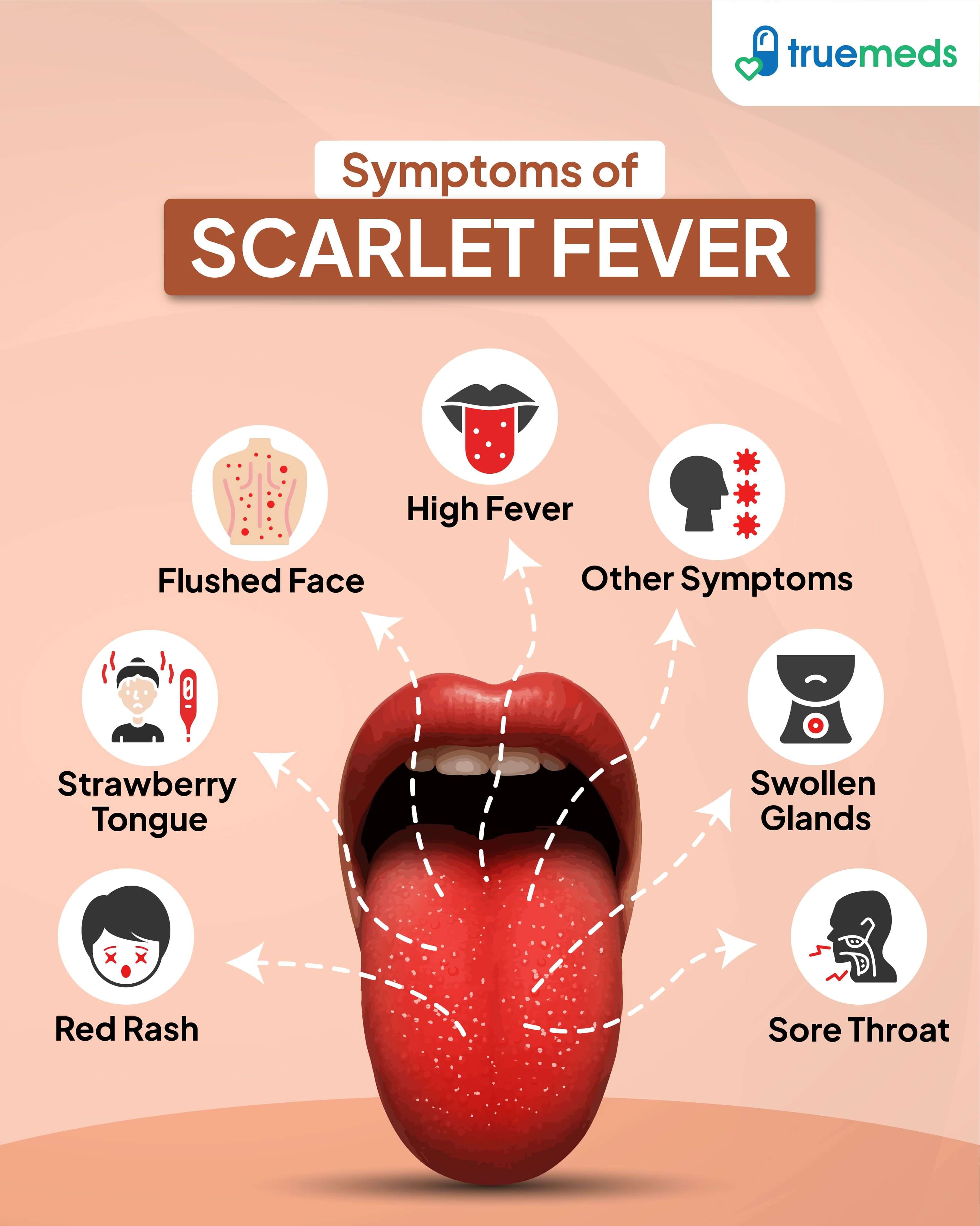 Infographic showing symptoms of scarlet fever including strawberry tongue, high fever, sore throat, red rash, flushed face, and swollen glands.
