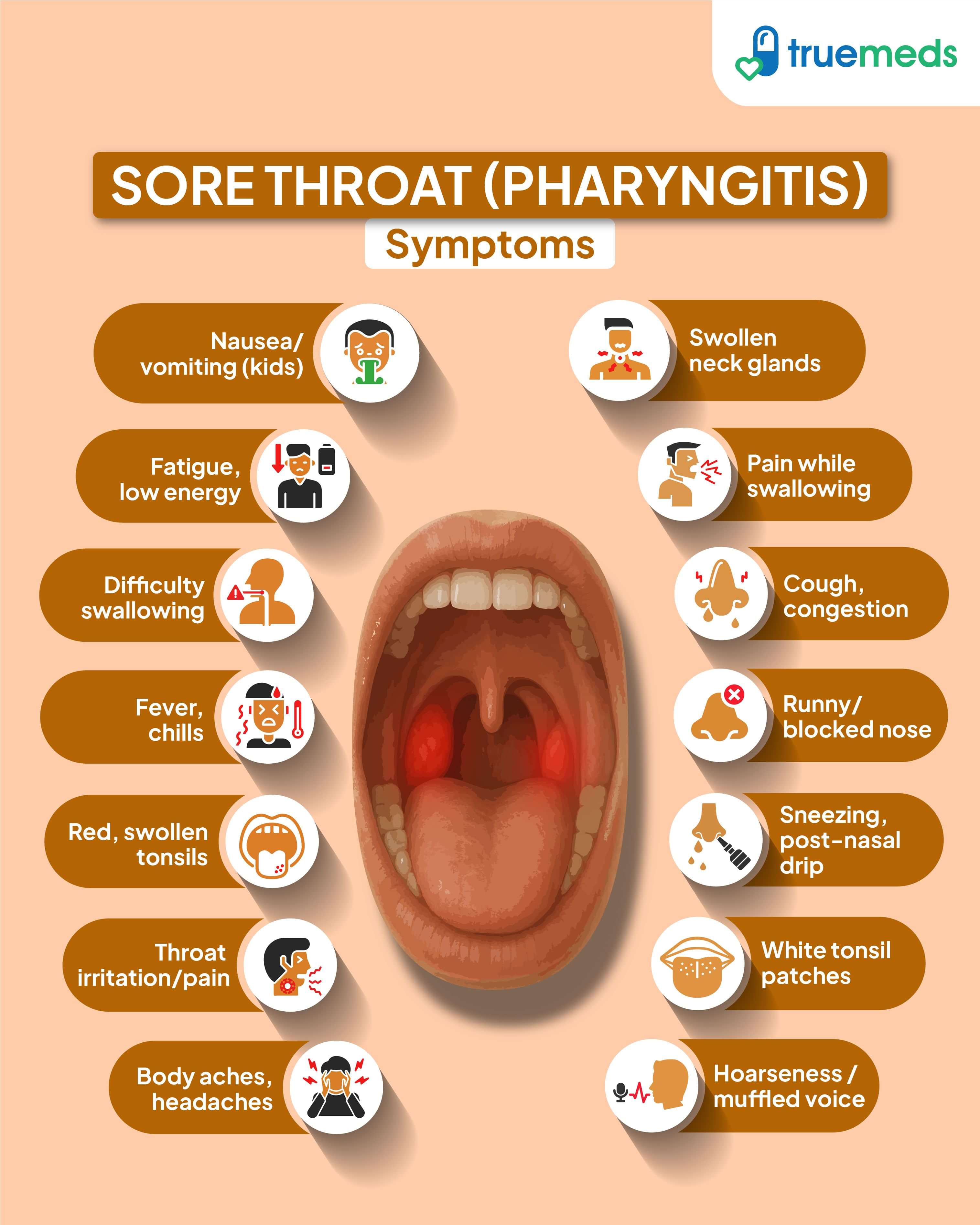 Infographic showing symptoms of sore throat or pharyngitis including swollen tonsils, cough, fever, difficulty swallowing, and fatigue