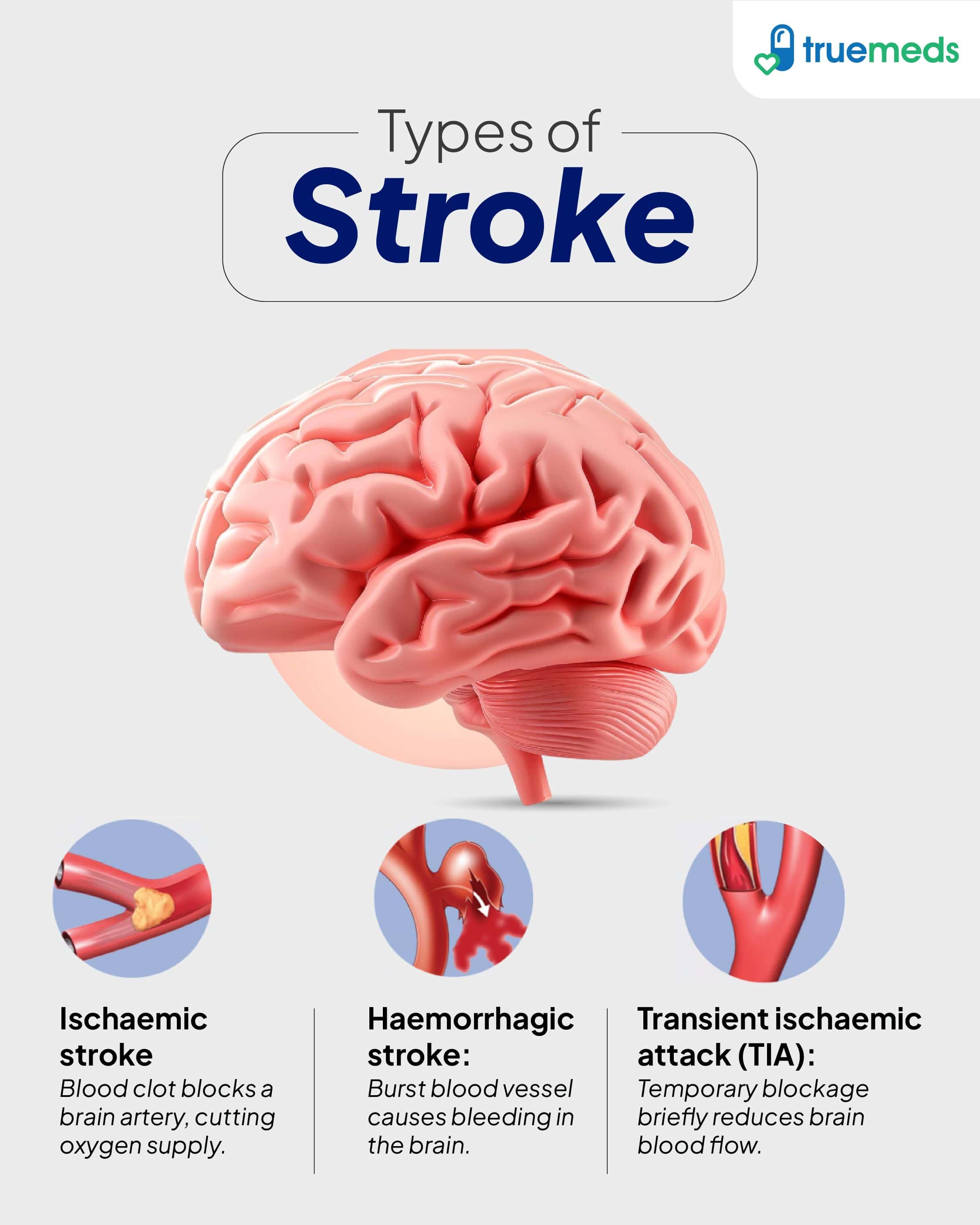 Types of Stroke infographic