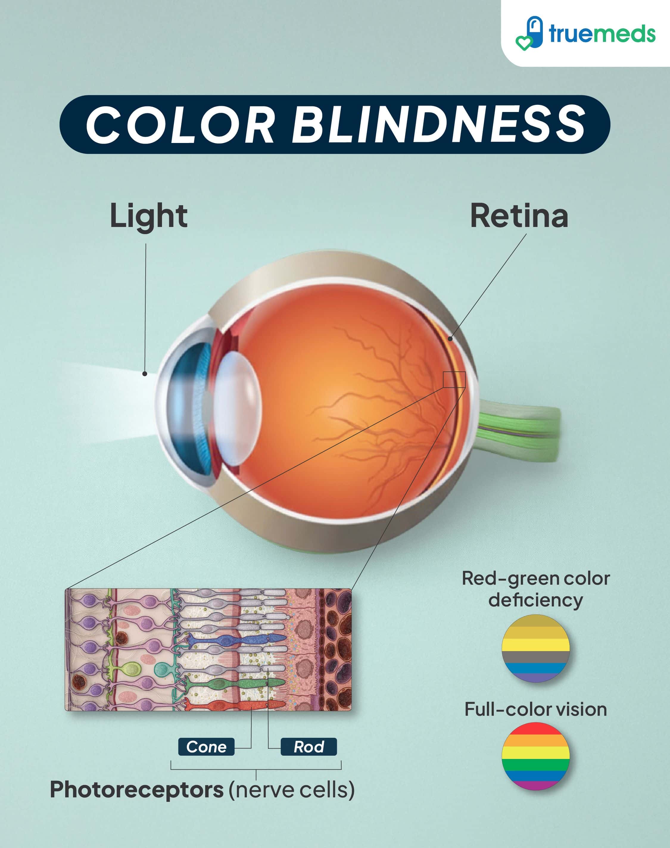 Visual representation showing color blindness in eye