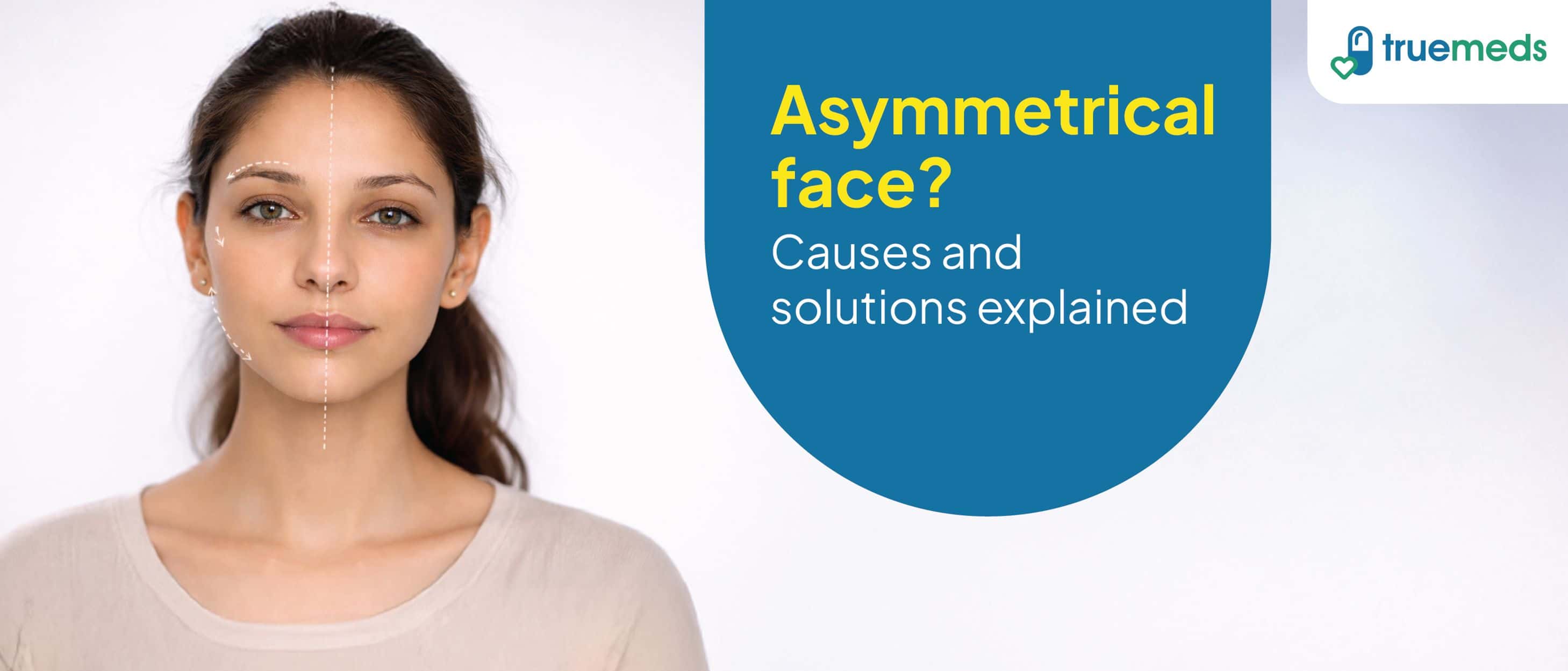 Asymmetrical Face: Causes and Treatment