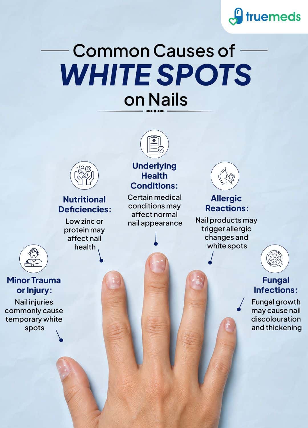 Common causes of white spots on nails including injury nutritional deficiencies fungal infections allergies and health conditions