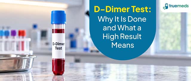 D-Dimer Test: Why It Is Done and What a High Result Means