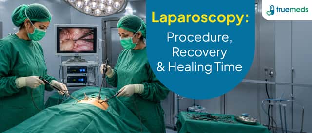 Laparoscopy: Meaning, Procedure and Stitch Healing Time
