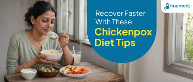 Best Diet for Chickenpox Recovery: What to Eat and Avoid