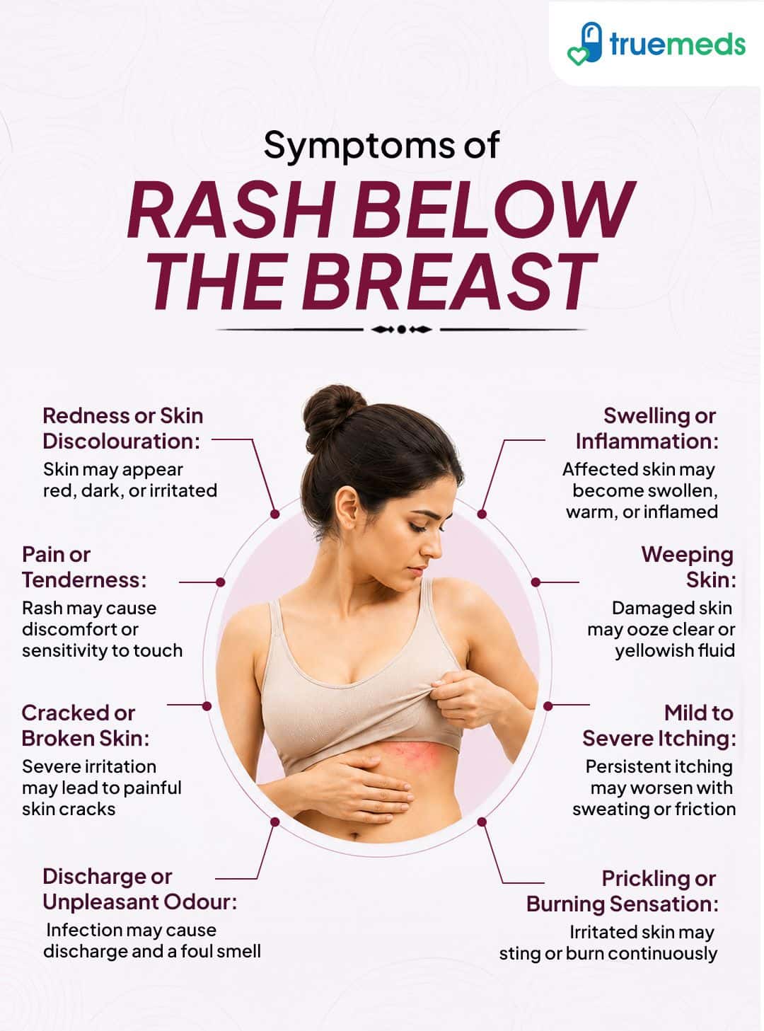 Symptoms of rash below the breast including redness itching swelling pain cracked skin burning sensation and discharge