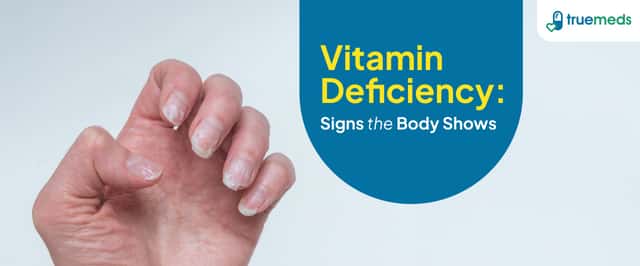 5 Warning Signs of Vitamin Deficiency