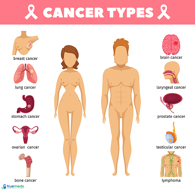 Cancer-types-in-Male-and-Female