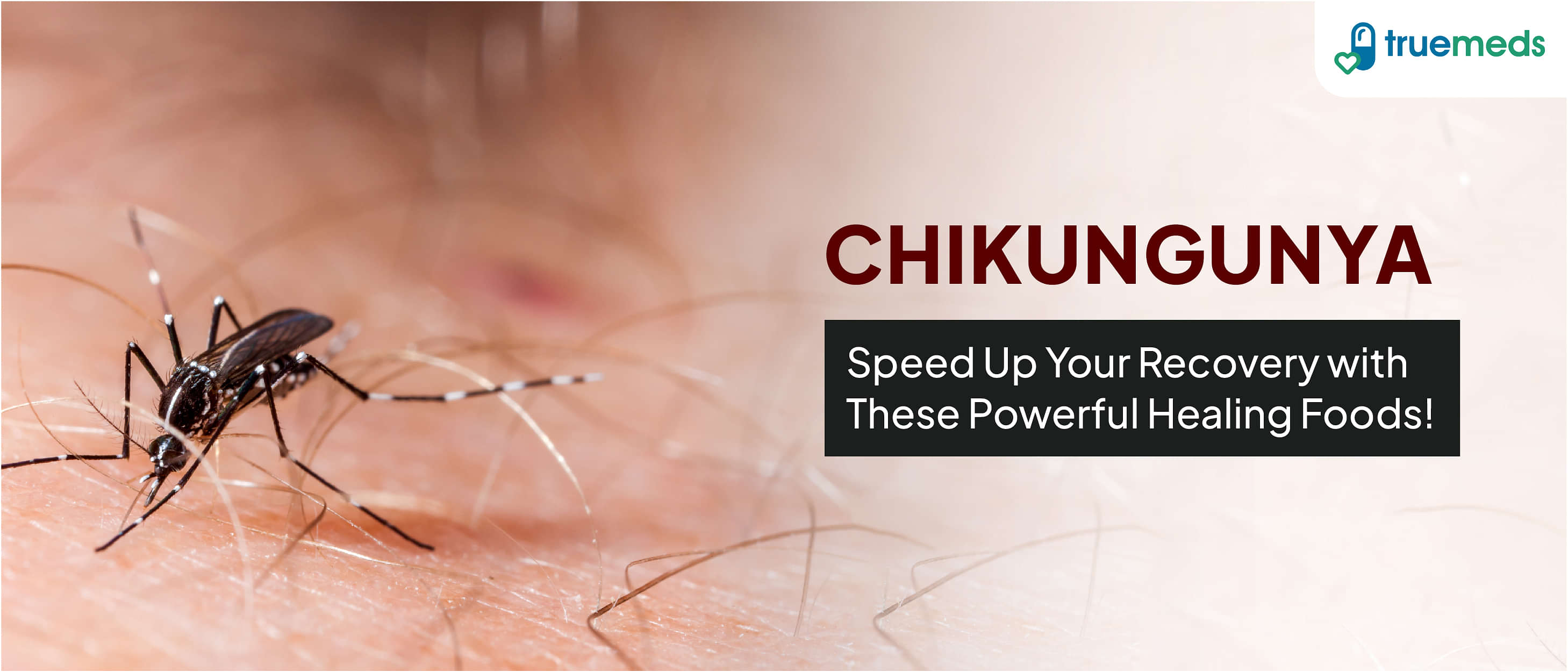 Chikungunya Diet: 12 Amazing Recovery Foods