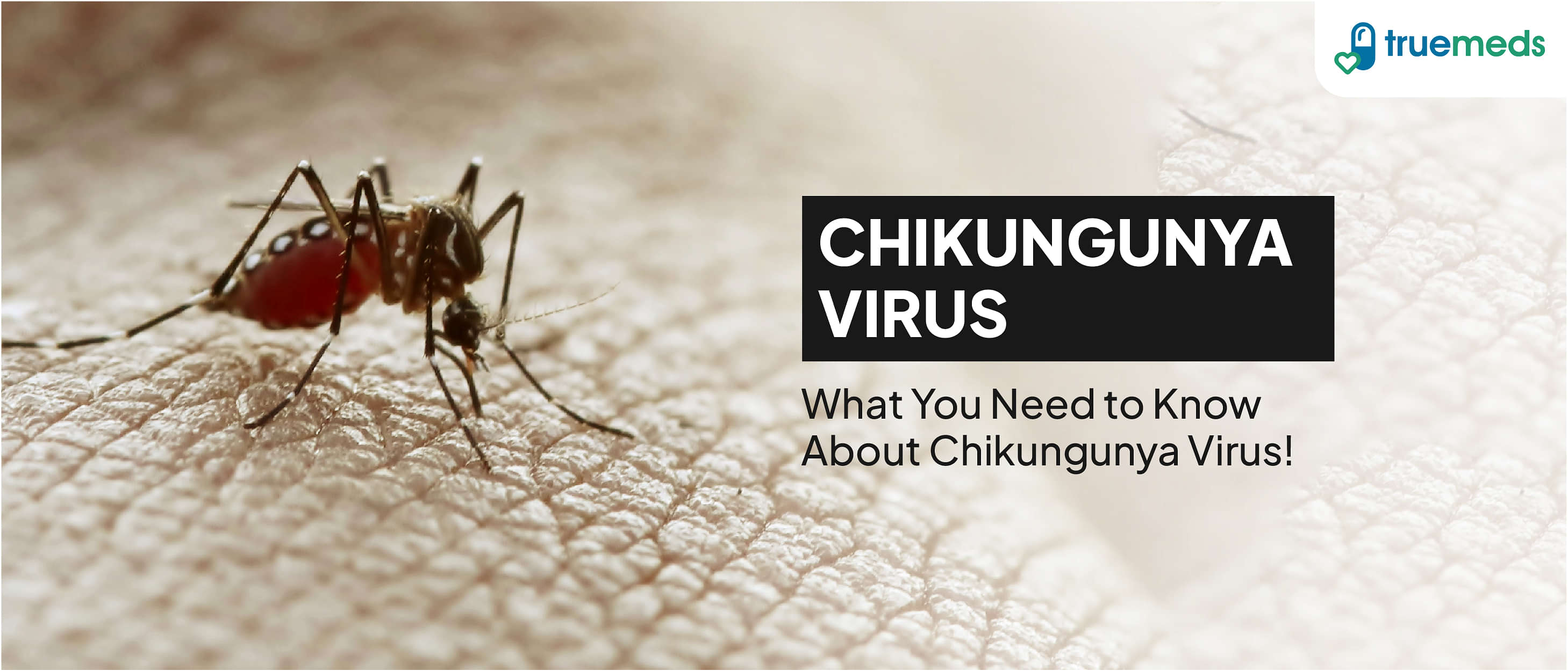 Chikungunya Virus- What Do You Need To Know?