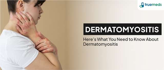 Dermatomyositis: Symptoms, Causes and Treatments