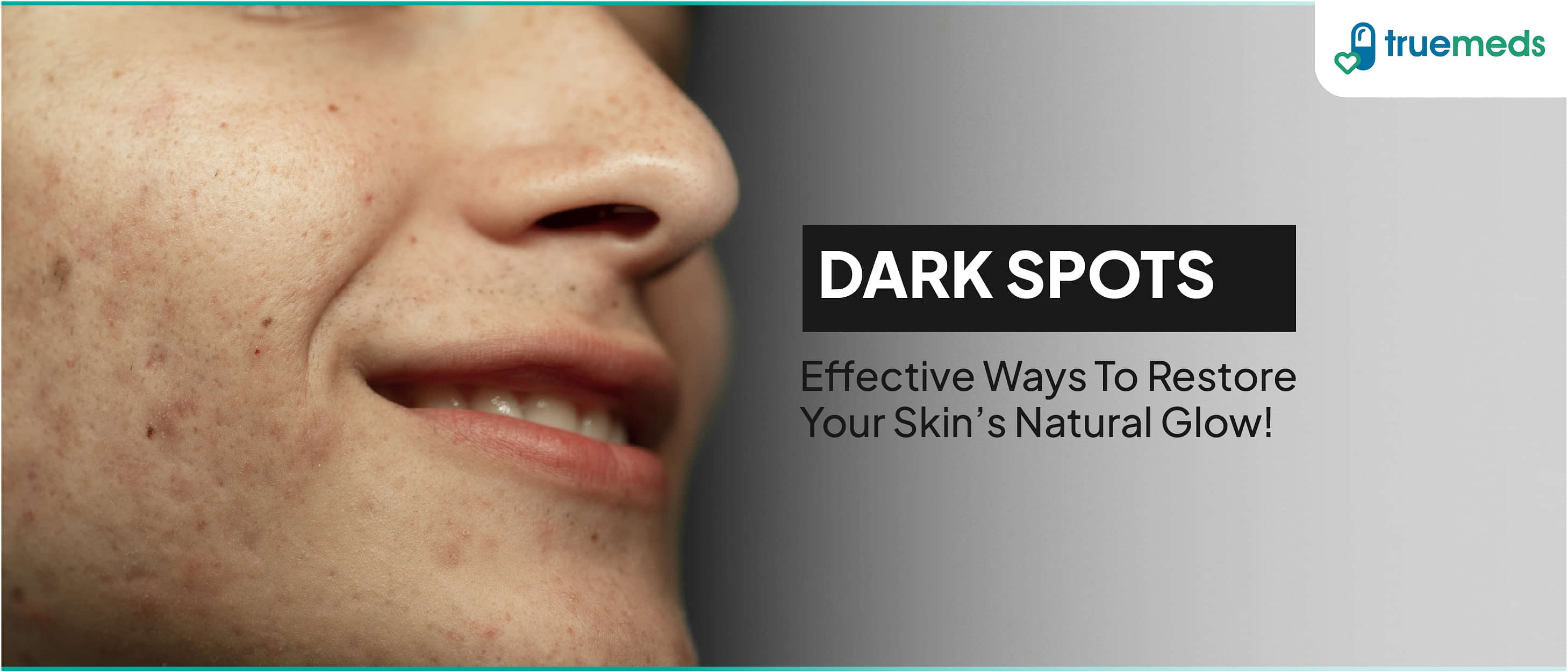 Effective Ways to Reduce Dark Spots on The Face