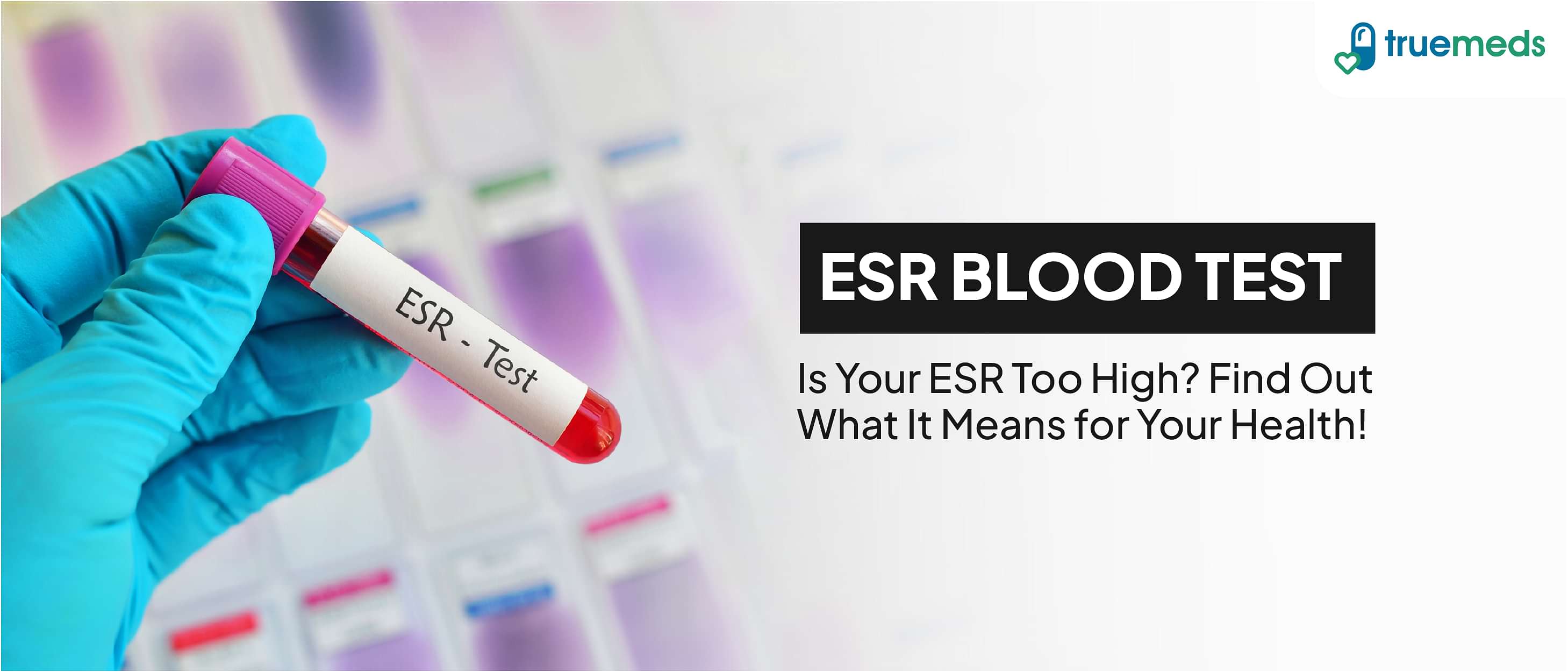 ESR Blood Test: Normal Range and Causes For High ESR Levels