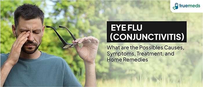 Eye Flu (Conjunctivitis): Causes, Symptoms, Treatment, and Home Remedies