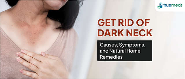 Natural Home Remedies to Get Rid of Dark Neck: Causes, Symptoms, and Treatments