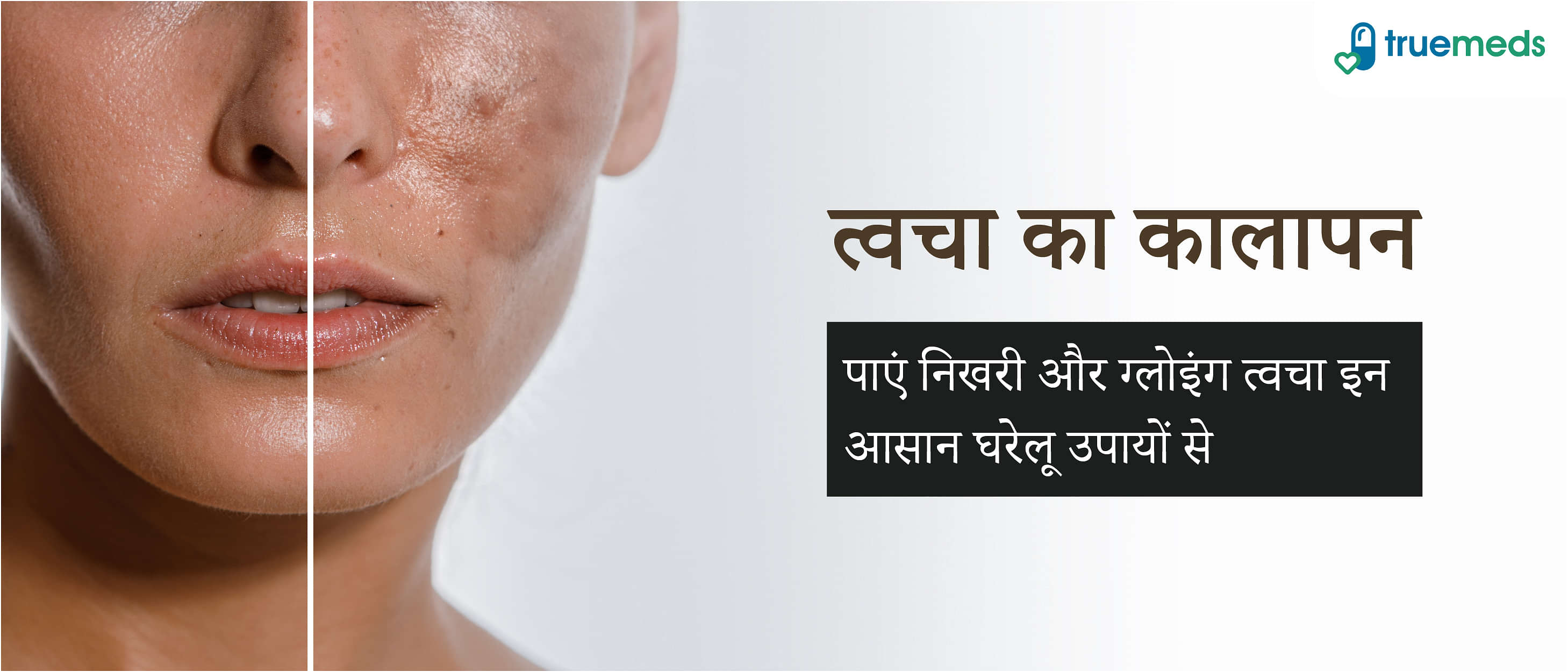 त्वचा का कालापन दूर करने के 10 असरदार घरेलू उपाय