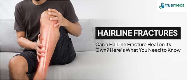 Hairline Fractures: Symptoms, Causes, and Treatment Options