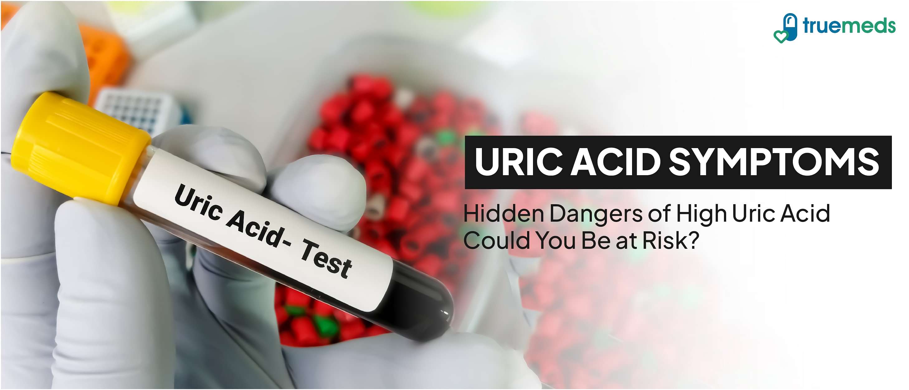 High uric acid level causes and symptoms