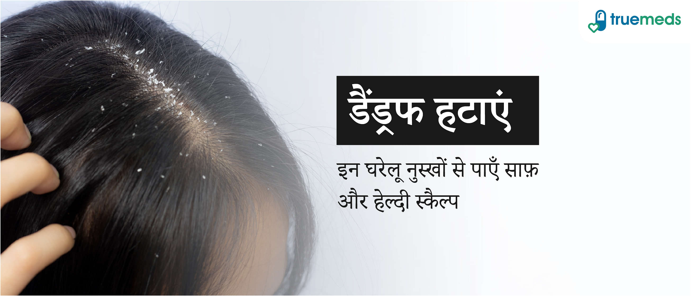 बालों से डैंड्रफ या रूसी हटाने के आसान घरेलू उपाय