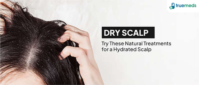 10 Home Remedies to Get Rid of Dry Scalp Naturally