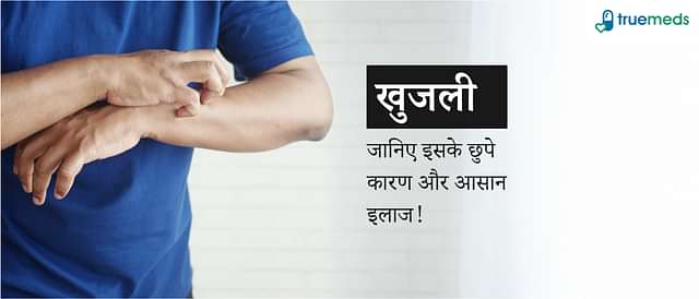 खुजली से छुटकारा कैसे पाएं? जानिए कारण, प्रकार और आसान उपाय