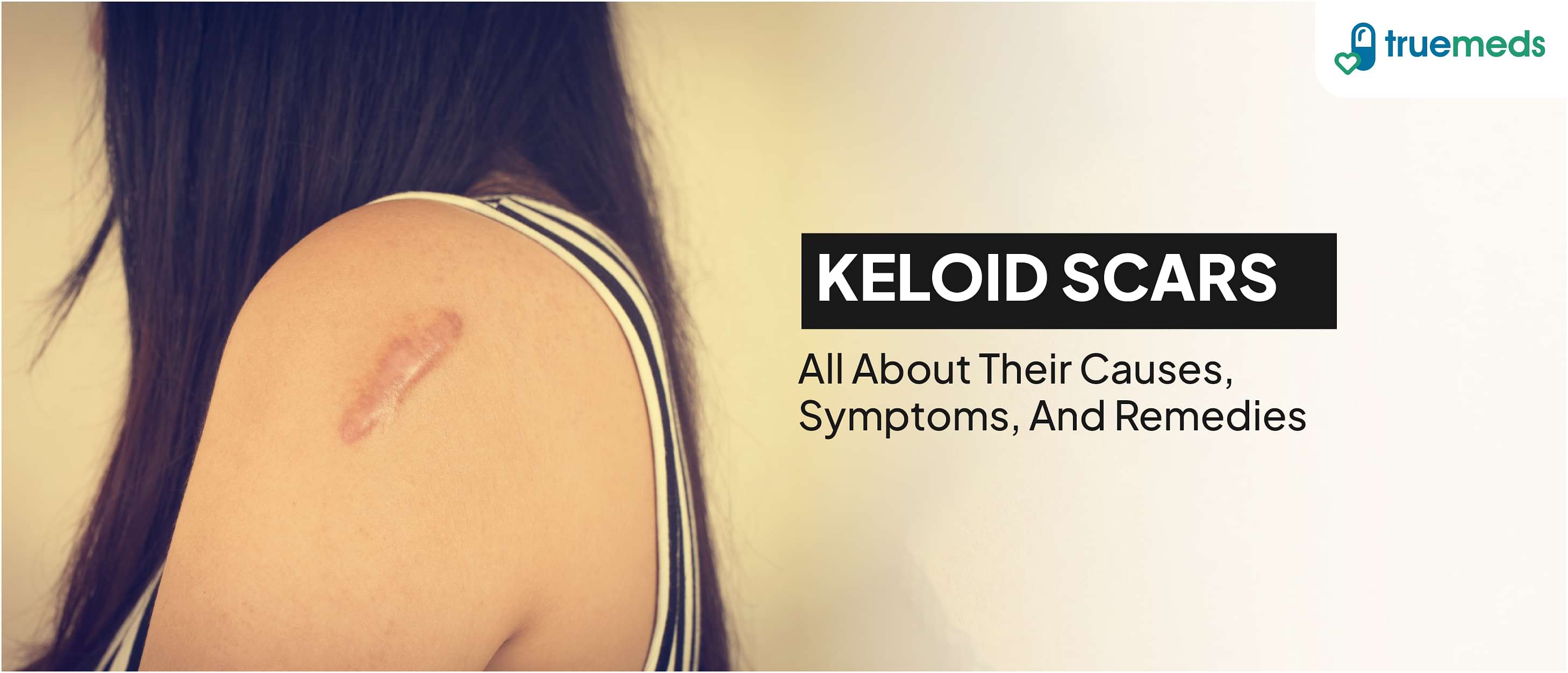 Keloid Scar: All you Need to Know