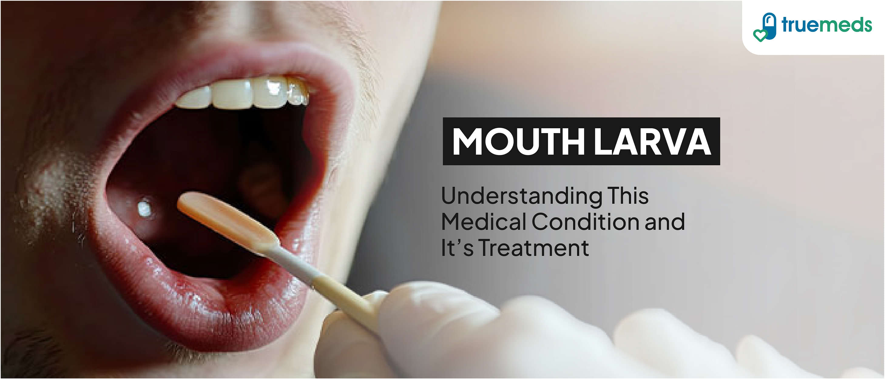 Mouth Larva: Understanding This Medical Condition And Its Treatment