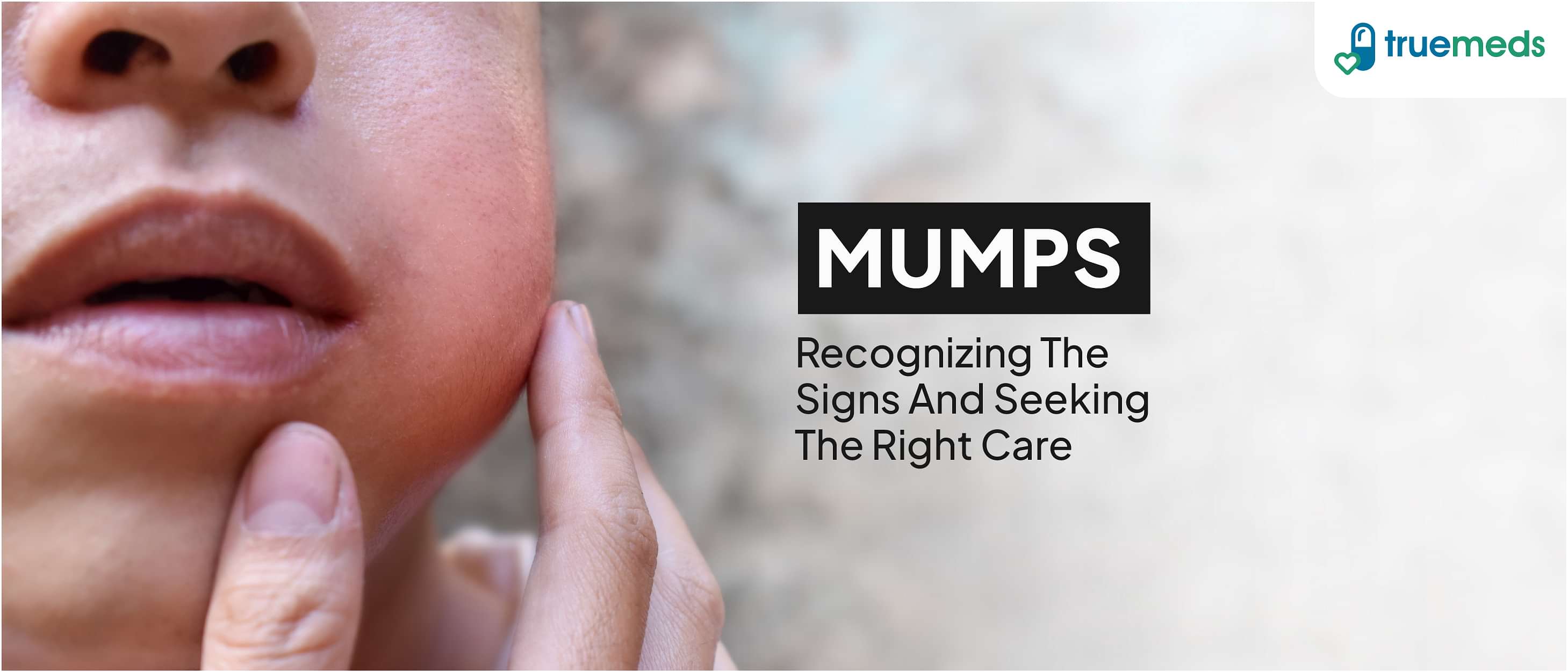 Mumps: Symptoms, Causes, Treatment &amp; Medication