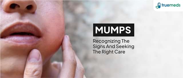 Mumps: Symptoms, Causes, Treatment &amp; Medication